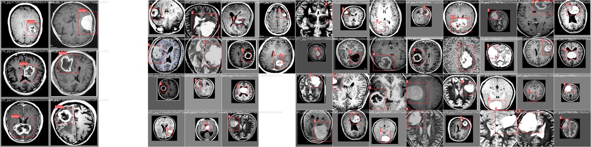 Brain tumor detection model output on medical scan images