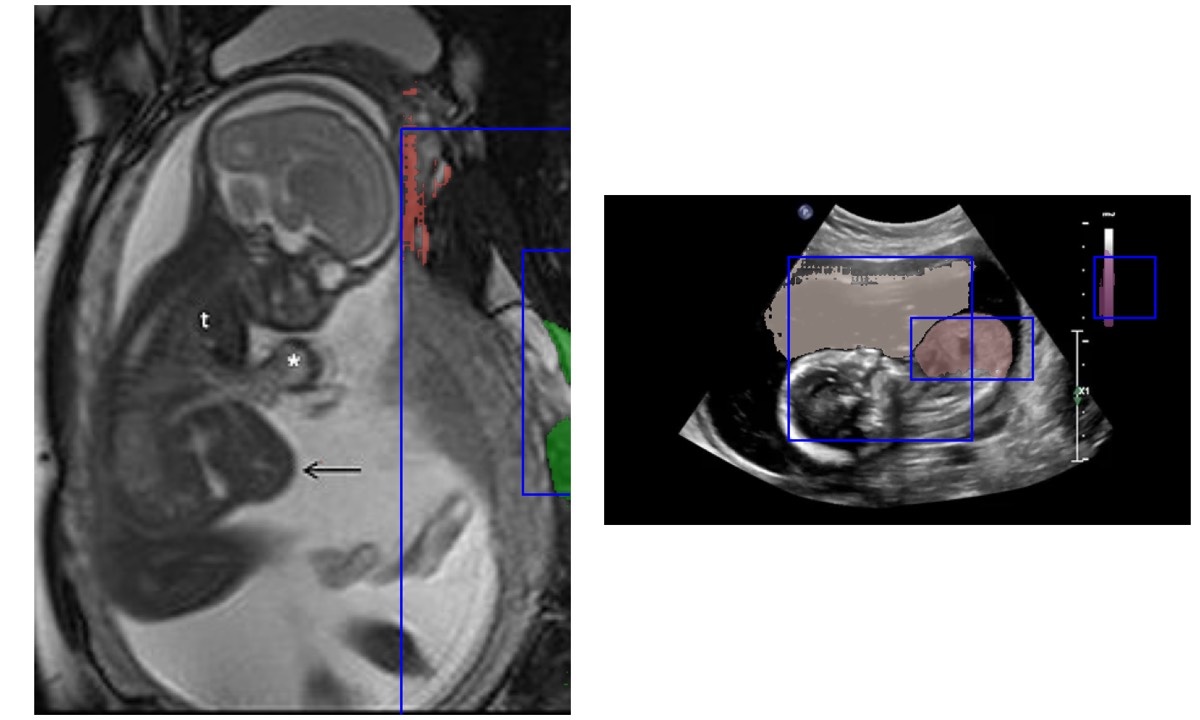 MRI scan grid used for medical-imaging computer vision work